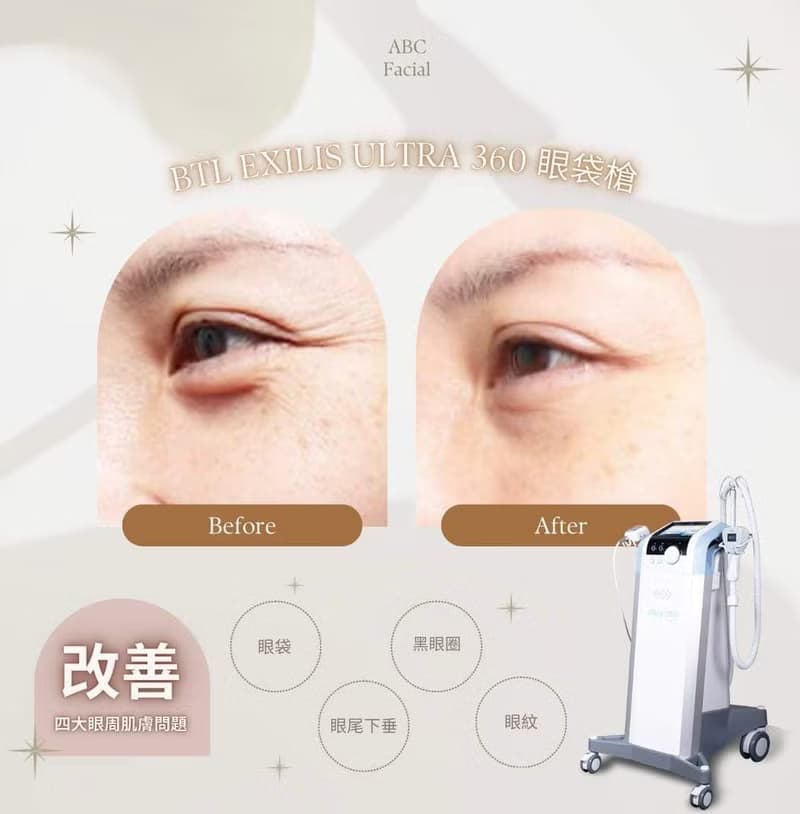 【數位】社交媒體小編/設計排版服務