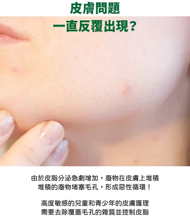 韓國 Recipe Box 韓兔  舒敏保濕調理凝乳