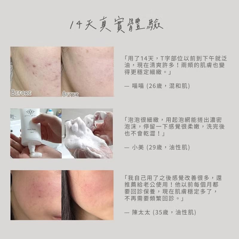 淨痘煥膚洗顏乳80ml