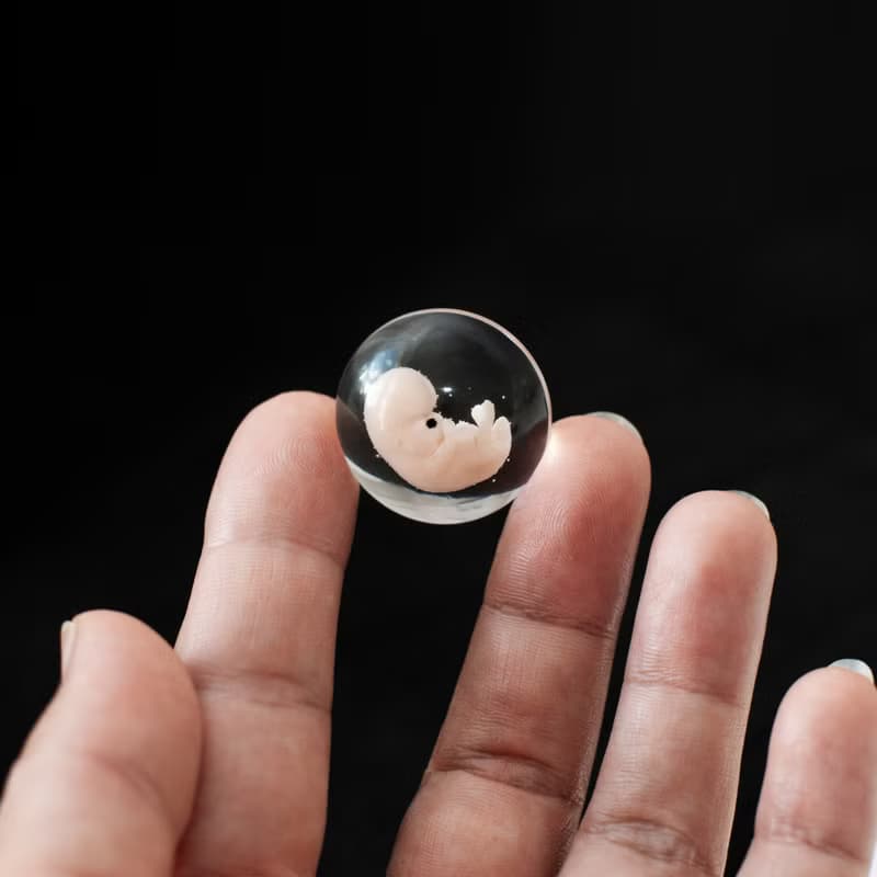 Embryo 7 weeks in Lens, 7 weeks pregnant, Sculpture cast in resin.