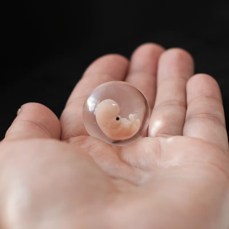 Embryo 7 weeks in Lens, 7 weeks pregnant, Sculpture cast in resin.