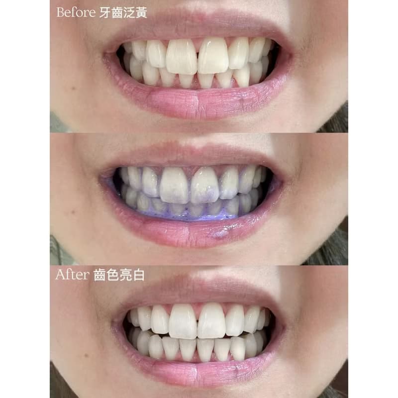 【熱銷補貨】ELLO Tooth 牙齒即刻煥白矯正膏55ml 美白牙膏 淨白