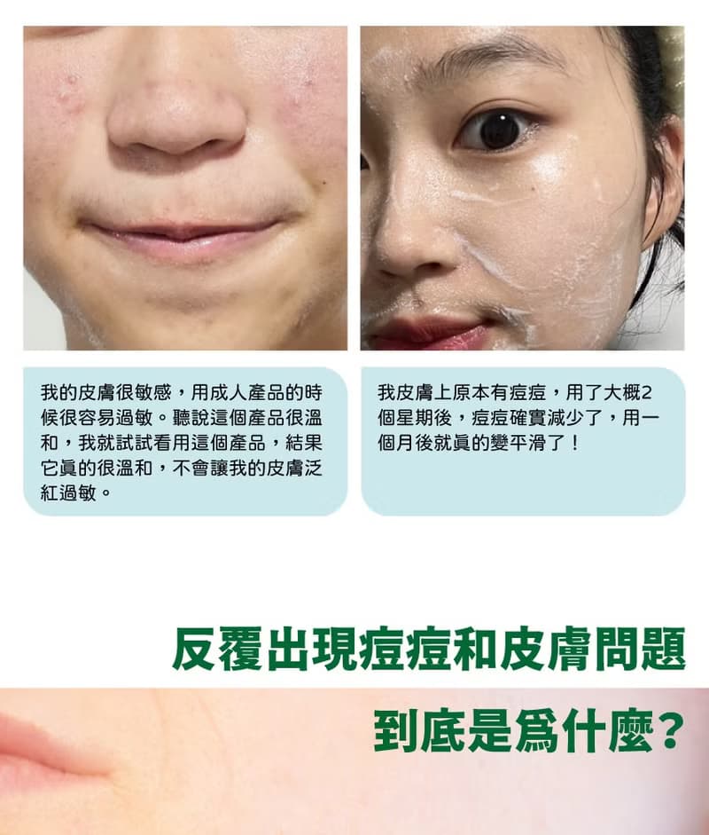 韓國 Recipe Box 韓兔 舒敏保濕舒緩精華露