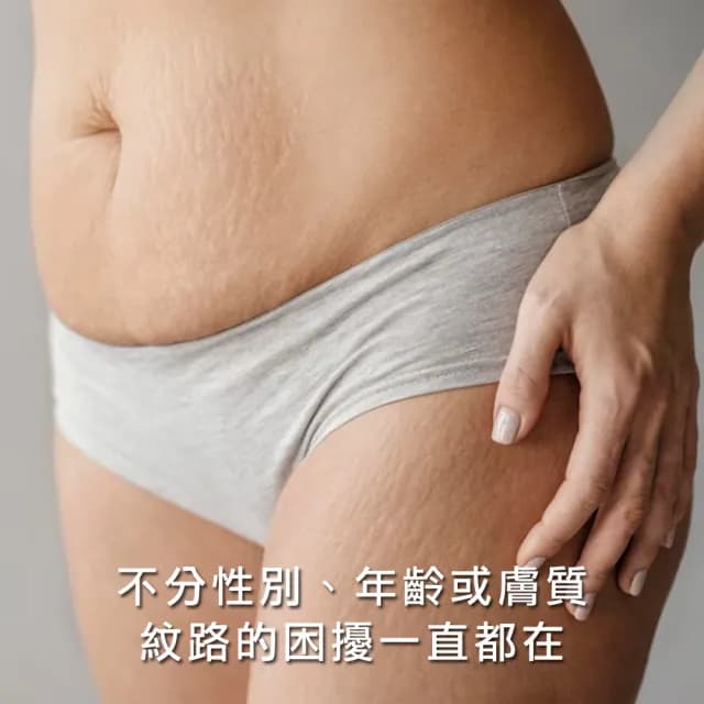 【Mederma 美德】草本緊緻撫紋霜(150g-孕膚霜/妊娠護理/減肥期/懷孕可用/孕期保養)