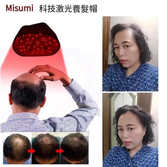 Misumi光療養髮帽(Led激光養髮帽 120顆高科技LED 強健髮根 護理頭皮 父親節 長輩禮物)