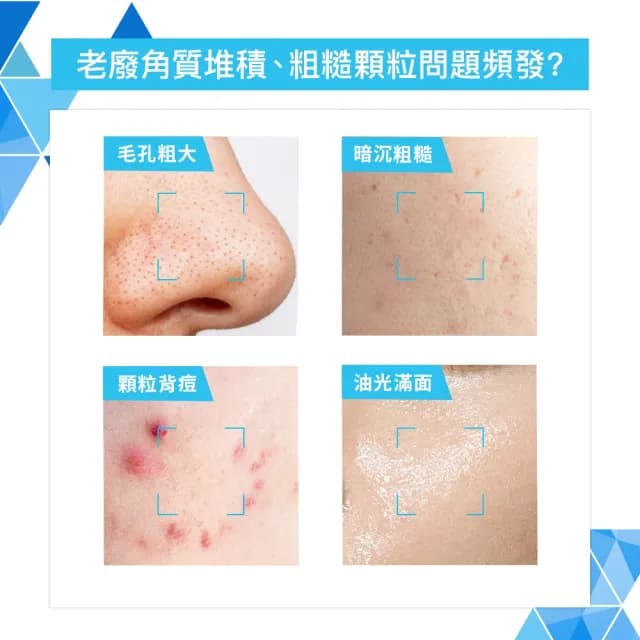 【CeraVe 適樂膚】限時特談雙入組★水楊酸煥膚淨嫩潔膚露 473ml X2(改善粗糙顆粒)