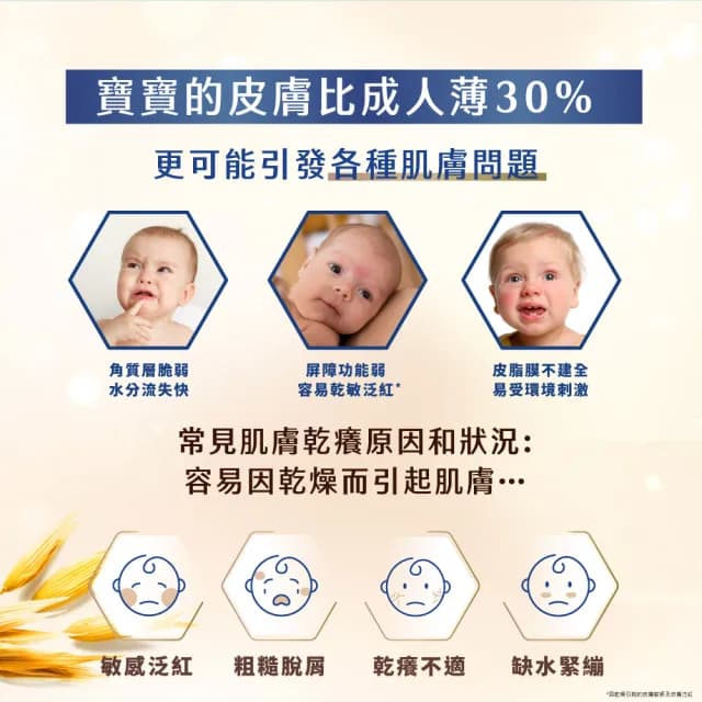 【Aveeno 艾惟諾】嬰兒燕麥益敏修護霜(141g_嬰兒乳液)