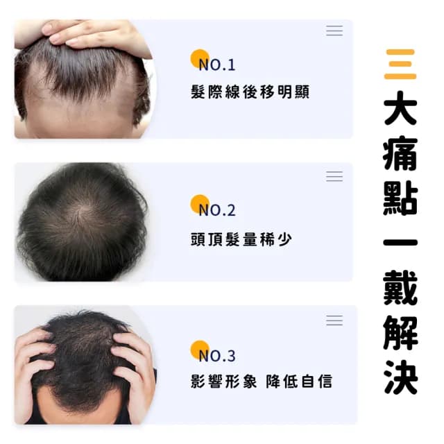 【一戴變身】韓系歐巴自然補整頂假髮(帥氣日常 蓬鬆瀏海 假髮片 遮白髮 遮頭禿 父親節禮物 男士假髮)