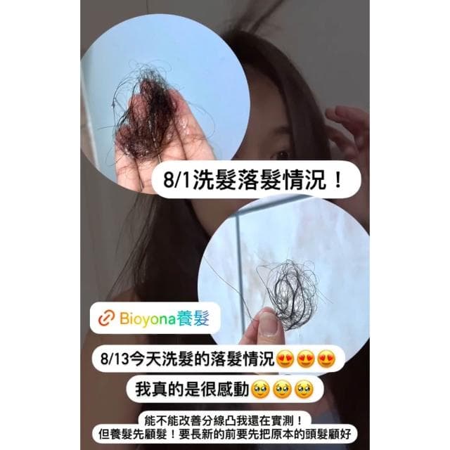 Bioyona 固髮洗髮精250ML『母親節禮物 』醫美 洗髮精 幹細胞 外泌體 外泌體生髮 外泌體洗髮精 掉髮洗髮精 稀疏 落建 落健 掉髮洗髮精 落髮 生髮液 雄性禿 健髮 增髮 產後掉髮 養髮洗髮精 落建洗髮精 生髮水 頭皮屑 生日禮物